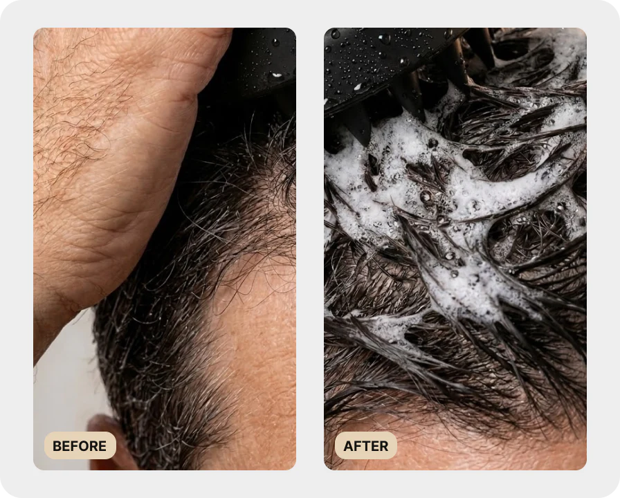 106-premium-scalp-brush-test-2.webp Premium Scalp Brush (TEST)