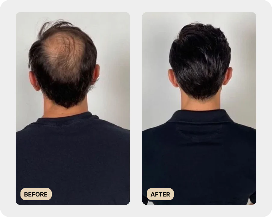 106-premium-scalp-brush-test-4.webp Premium Scalp Brush (TEST)