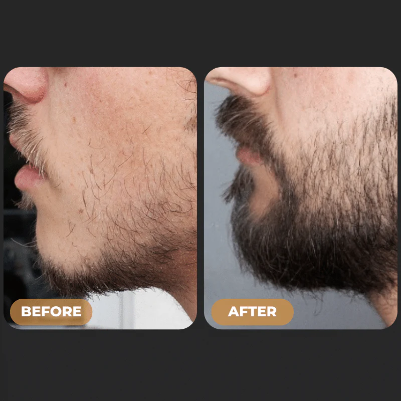 135-spartantm-beard-growth-activator-4.webp SPARTAN™ - Beard Growth Activator