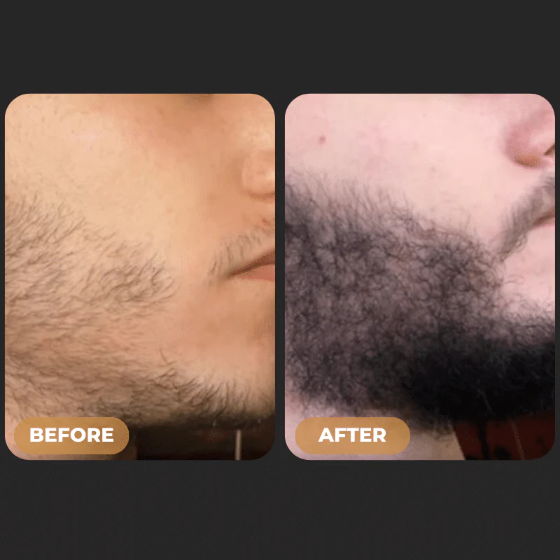 264-spartantm-root-activator-spray-beard-growth-bundle-3.webp SPARTAN™ - Root Activator Spray & Beard Growth Bundle