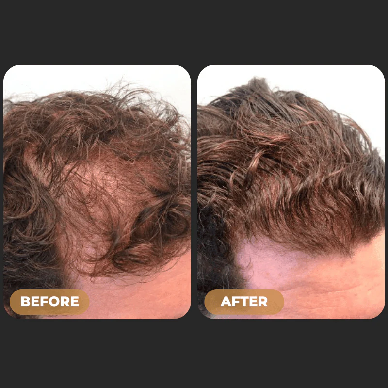 276-spartantm-root-activator-shampoo-increased-hair-growth-with-just-4-washes-a-week-3.webp SPARTAN™ Root Activator Shampoo - Increased Hair Growth with Just 4 Washes a Week*