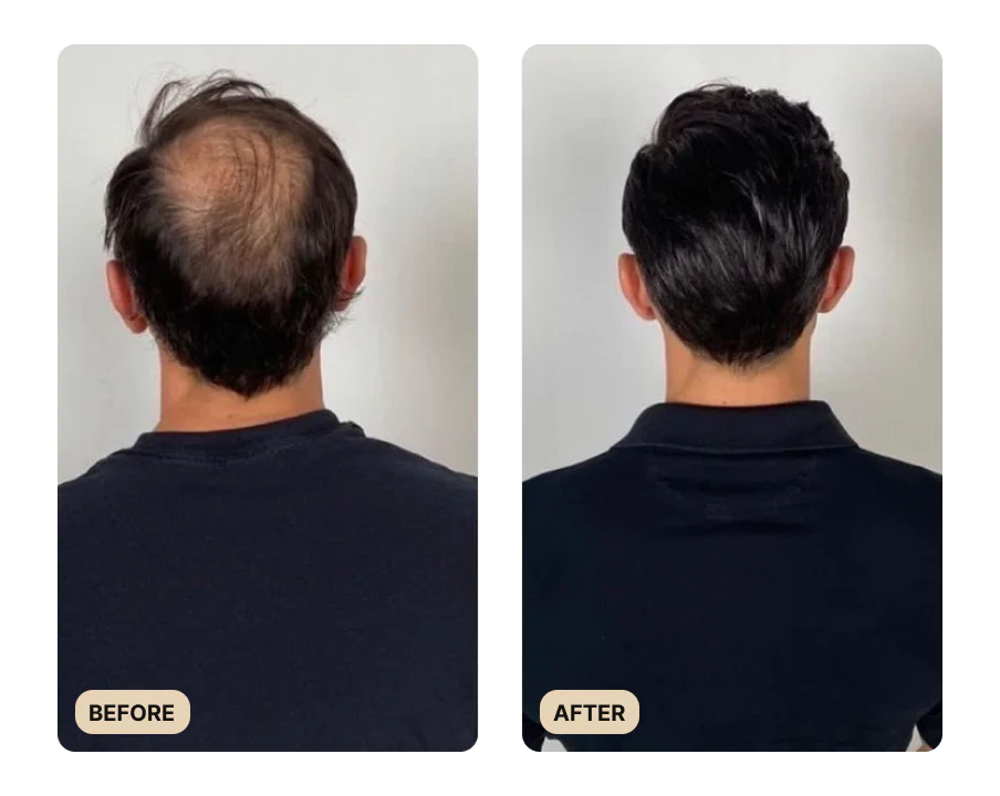 36-full-hair-growth-system-test-4.webp Full Hair Growth System (TEST)