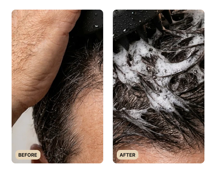 36-full-hair-growth-system-test-6.webp Full Hair Growth System (TEST)