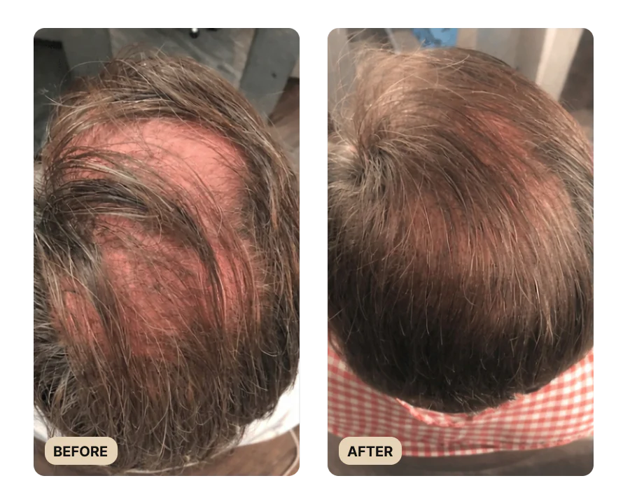 Root Activator Spray (TEST)