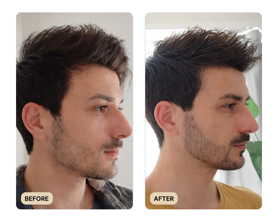 56-beard-growth-oil-test-4.webp Beard Growth Oil (TEST)