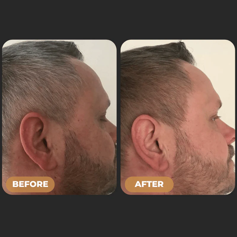 76-spartantm-instant-hair-dye-shampoo-6.webp SPARTAN™ - Instant Hair Dye Shampoo