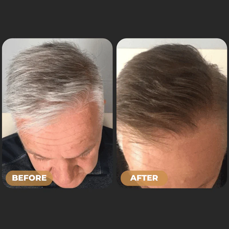 76-spartantm-instant-hair-dye-shampoo-7.webp SPARTAN™ - Instant Hair Dye Shampoo