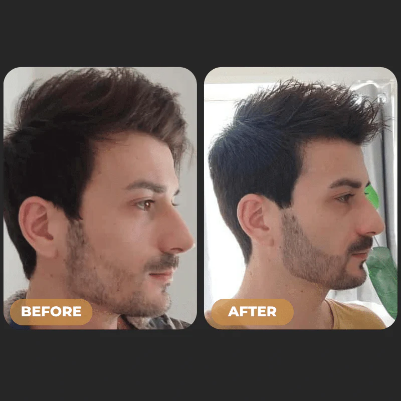 SPARTAN™ - Beard Growth Oil